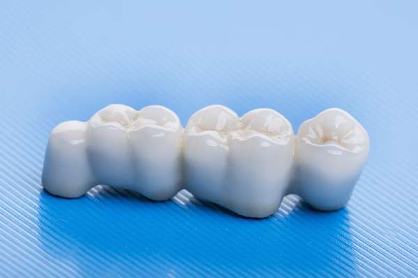 How Many Teeth Can Dental Bridges Replace from Sylmar Dental & Braces in Los Angeles, CA