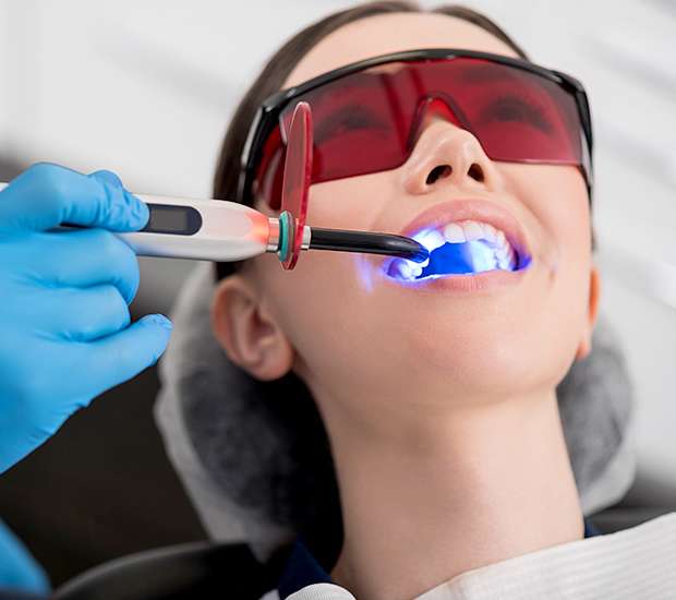 Los Angeles Professional Teeth Whitening